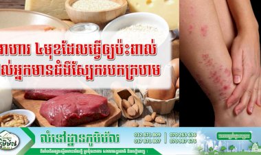 [វីដេអូ] អាហារ ៤មុនដែលធ្វើឲ្យប៉ះពាល់ដល់អ្នកមានជំងឺស្បែករបកក្រហម