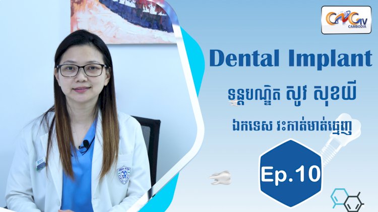 [វីដេអូ] Ep.10 ប្រធានបទ៖ Dental implant