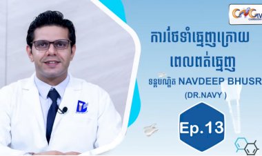 [វីដេអូ] Ep.13 ប្រធានបទ៖ការថែទាំធ្មេញក្រោយពេលពត់ធ្មេញ