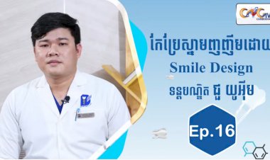 [វីដេអូ]| Ep.16 ប្រធានបទ៖ កែប្រែស្នាមញញឹមដោយ Smile Design