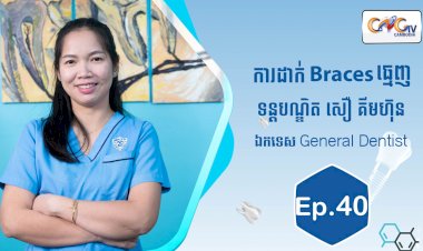 [វីដេអូ] Ep.40 ប្រធានបទ៖   ការដាក់ braces ធ្មេញ