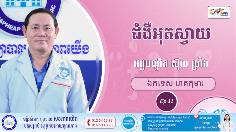 CNGTV | កម្មវិធី មាតាឆ្លាតវៃ Ep.11 ជំងឺអុតស្វាយ