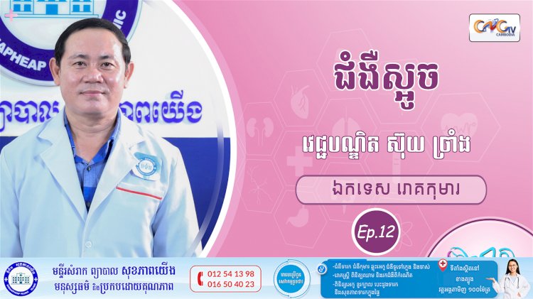 CNGTV | កម្មវិធី មាតាឆ្លាតវៃ Ep.12 ជំងឺស្អូច