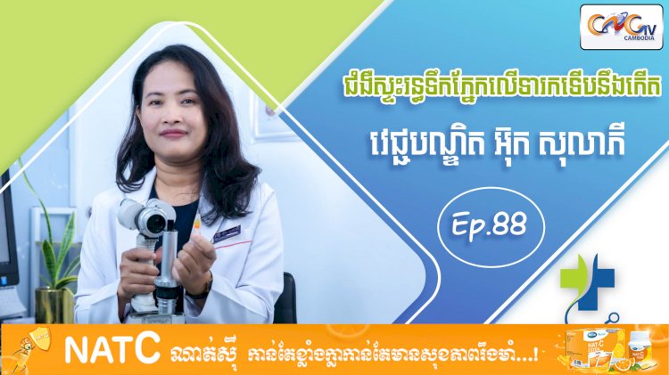 [វីដេអូ] Ep 88 ប្រធានបទ៖ ជំងឺស្ទះរន្ធទឹកភ្នែកលើទារកទើបនឹងកើត