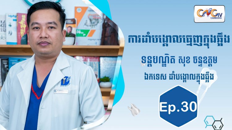 [វីដេអូ] Ep.30 ប្រធានបទ៖ ការដាំបង្គោលធ្មេញក្នុងឆ្អឹង