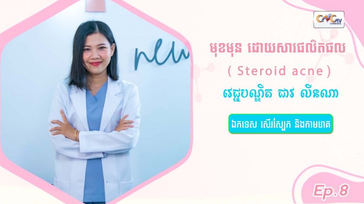 SkinTalk Ep.8 ប្រធានបទ៖ មុខមុនដោយសារផលិតផល ( Steroid acne )