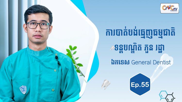 [វីដេអូ] Ep.55 ប្រធានបទ៖ ការបាត់បង់ធ្មេញធម្មជាតិ