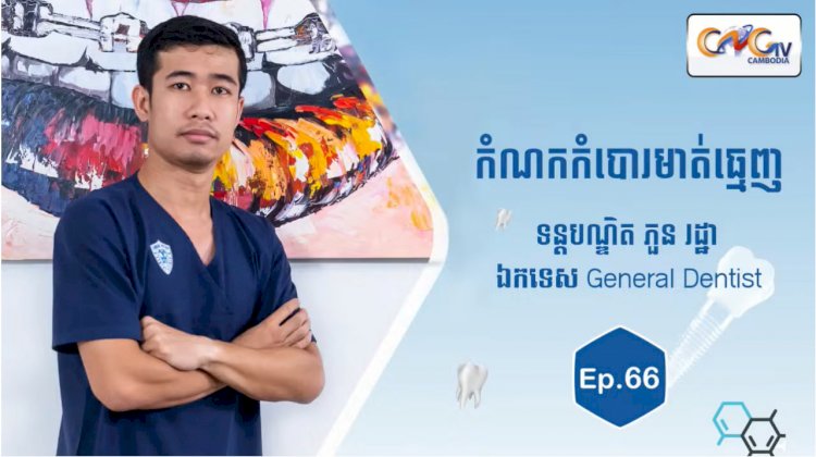 [វីដេអូ] Ep.66 ប្រធានបទ៖  កំណកកំបោរមាត់ធ្មេញ