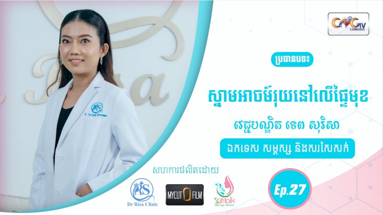 SkinTalk Ep.27 ប្រធានបទ៖ ស្នាមអាចម៍រុយនៅលើផ្ទៃមុខ