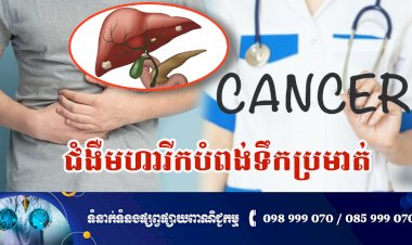 ប្រធានបទ ៖ ជំងឺមហារីកបំពង់ទឹកប្រមាត់ (Cholangiocarcinoma)