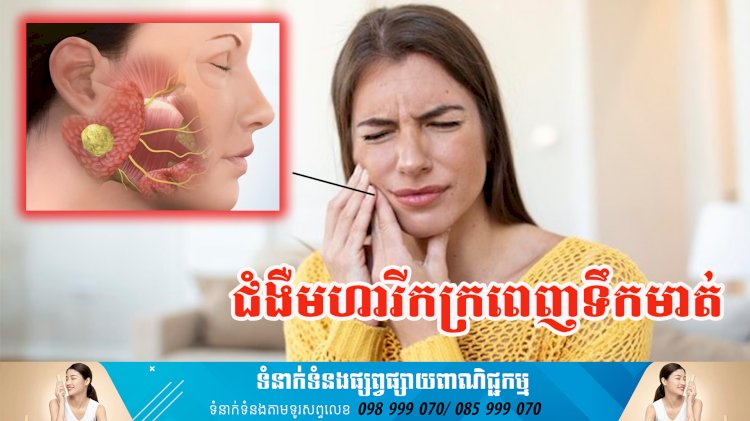 ប្រធានបទ ៖ ជំងឺមហារីកក្រពេញទឹកមាត់