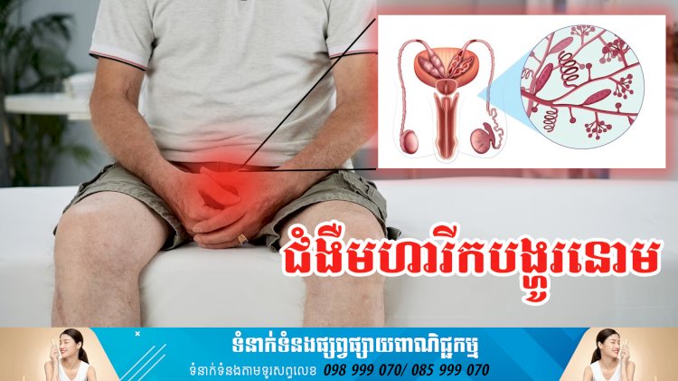 ប្រធានបទ៖ ជំងឺមហារីកបង្ហូរនោម