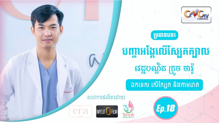 SkinTalk Ep.18 ប្រធានបទ៖ បញ្ហាអង្គែលើស្បែកក្បាល