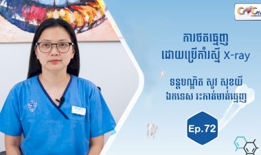 [វីដេអូ] Ep.72 ប្រធានបទ៖ ការថតធ្មេញដោយប្រើកាំរស្មី X-ray