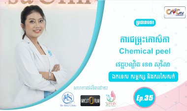 SkinTalk Ep.35 ប្រធានបទ៖ ការជម្រុះកោសិកា Chemical peel