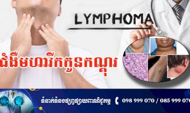 ប្រធានបទ ៖ ជំងឺមហារីកកូនកណ្តុរ