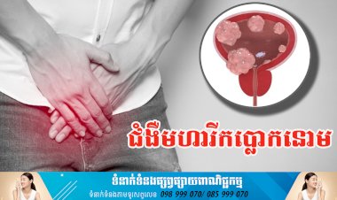 ប្រធានបទ ៖ ជំងឺមហារីកប្លោកនោម