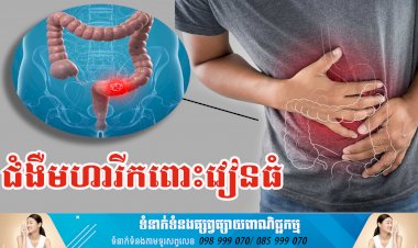 ប្រធានបទ ៖ ជំងឺមហារីកពោះវៀនធំ