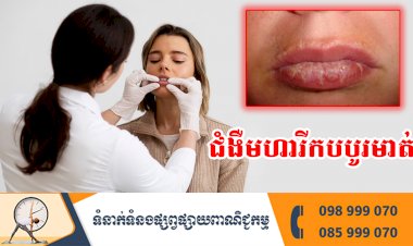 ប្រធានបទ ៖ ជំងឺមហារីកបបូរមាត់
