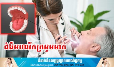 ប្រធានបទ ៖ ជំងឺមហារីកក្រអូមមាត់