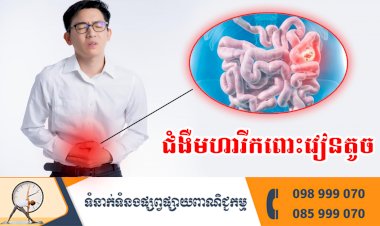 ប្រធានបទ ៖ ជំងឺមហារីកពោះវៀនតូច
