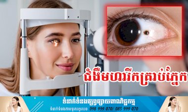 ប្រធានបទ ៖ ជំងឺមហារីកគ្រាប់ភ្នែក