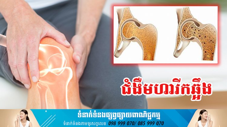 ប្រធានបទ ៖ ជំងឺមហារីកឆ្អឹង
