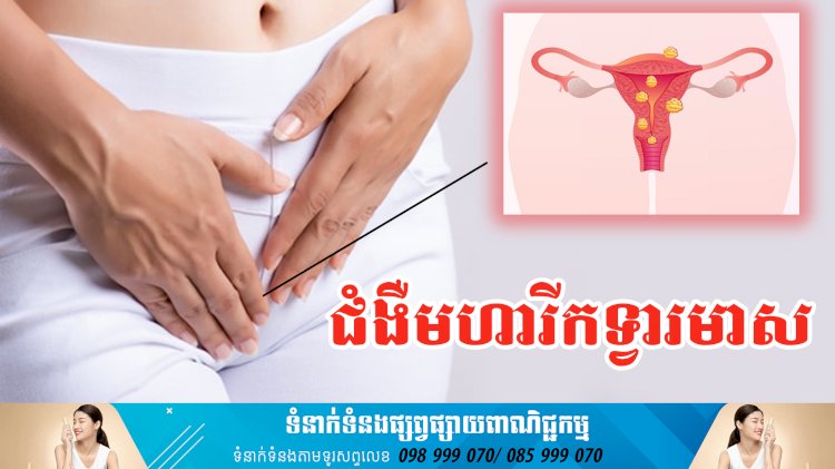 ប្រធានបទ ៖ ជំងឺមហារីកទ្វារមាស