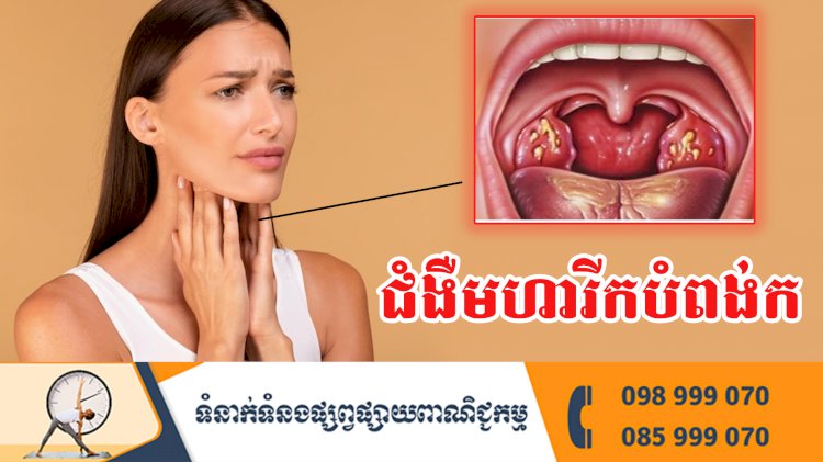 ប្រធានបទ ៖ ជំងឺមហារីកបំពង់ក